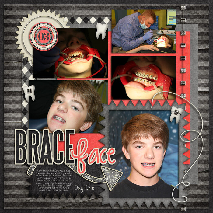Brace Face Project Idea