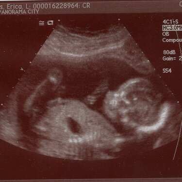 Baby at 19 weeks