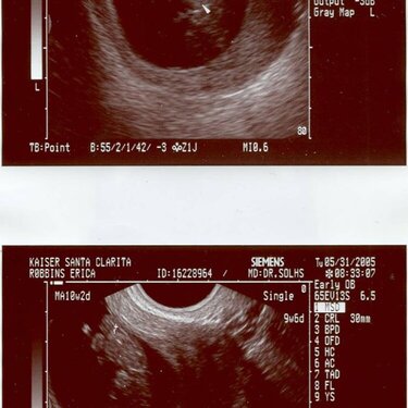 Our baby&#039;s first pictures!!!