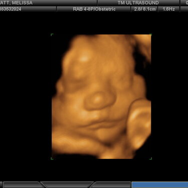 Caden @ 30 weeks