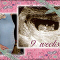 9 weeks Pregnant