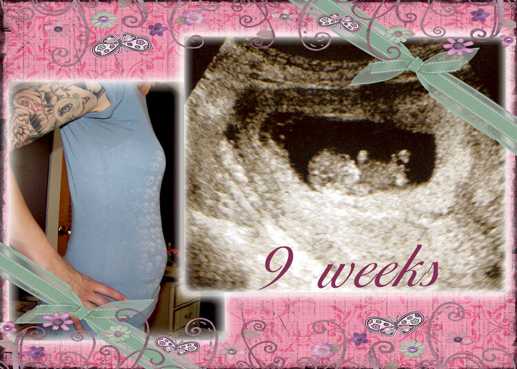 9 weeks Pregnant