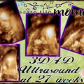 27 week Ultrasound