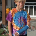 Liams broken arm