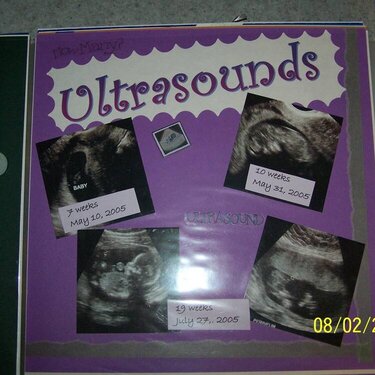 Ultrasounds