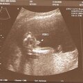 It's a Boy! July 18th 2006 19 weeks 1 day