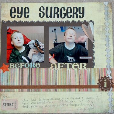 Eye surgery