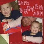 Sam&#039;s Broken Arm 1