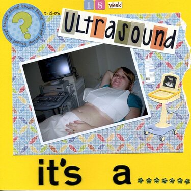 18 week ultrasound