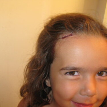 Cute Girl with Stitches!