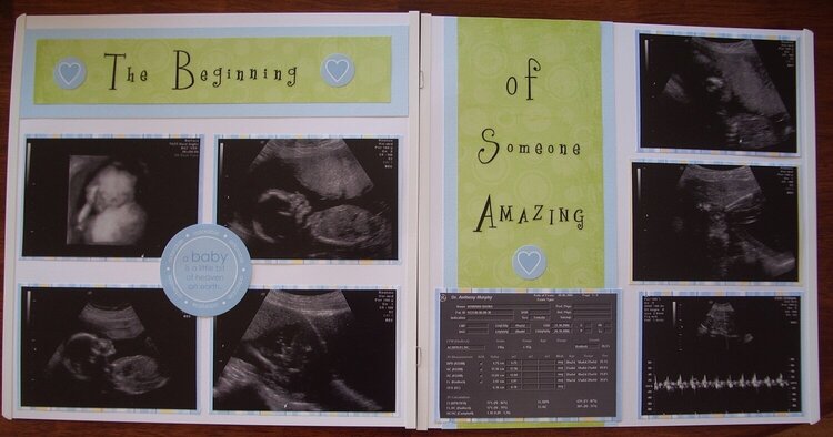 Ultrasound Page