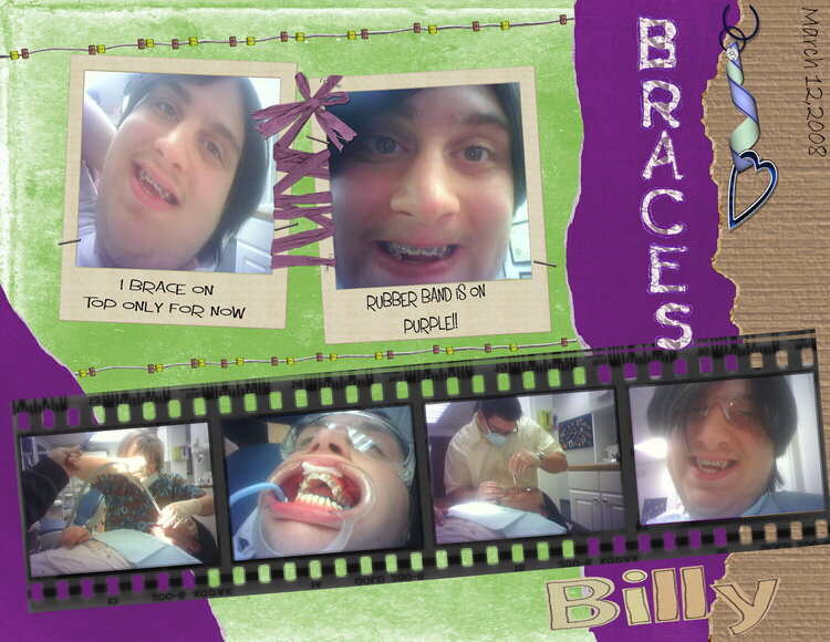 Finally BIL&#039;s Turn his braces on