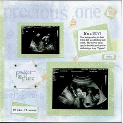 Ultrasound-boy (right)