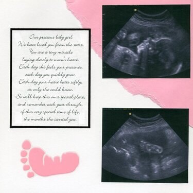 25 week ultrasound ~ left side
