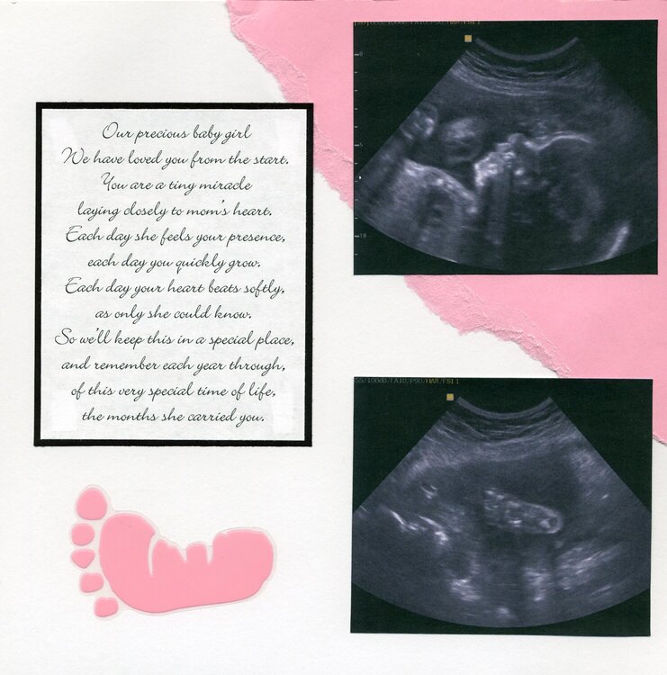 25 week ultrasound ~ left side
