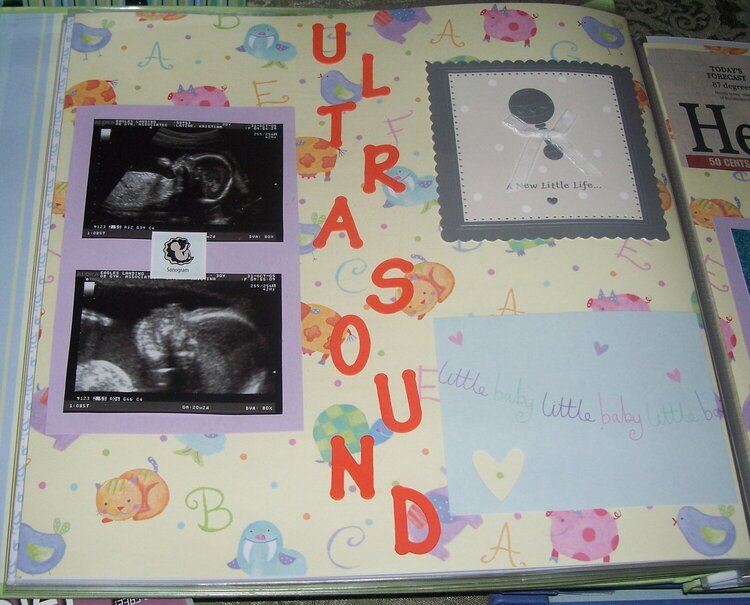 Ultrasound pics