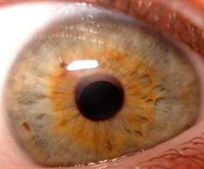 My Kewl Eye!