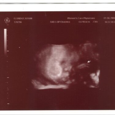 34 wk 4 day ultrasound pics - face 2