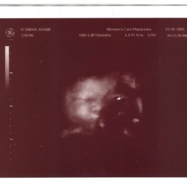 34 wk 4 day ultrasound pics - face 1