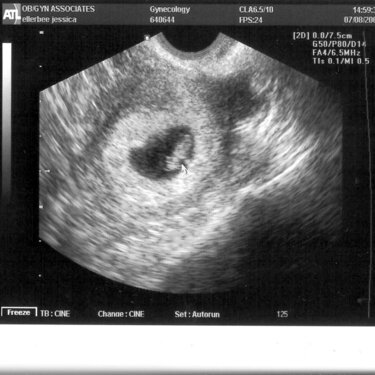 Our Baby&#039;s First Photo!!