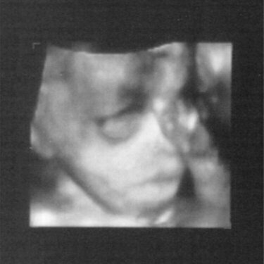 Ultrasound 29 weeks