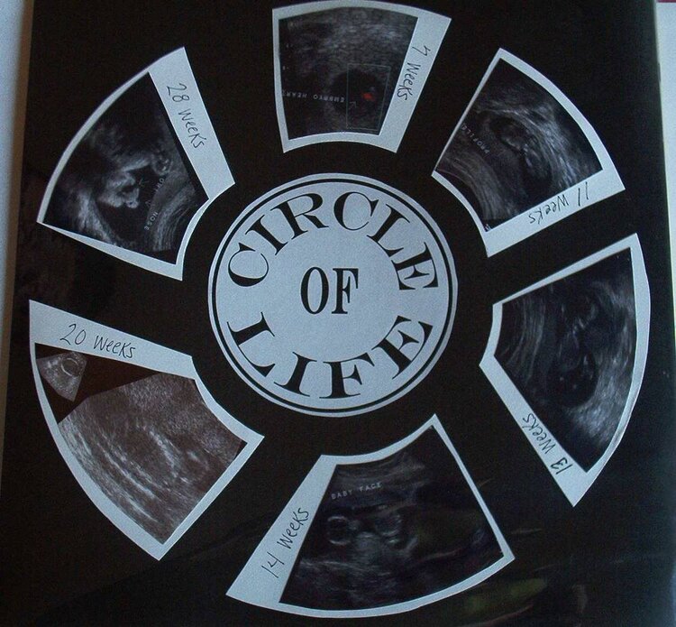 Alexa - ultrasound pics