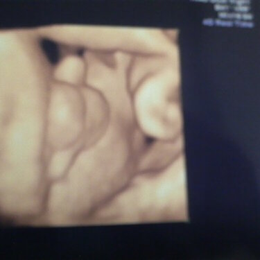 34 WKS. 3D U/S Private Part. Its a boy !