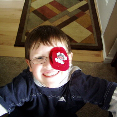 Brett, the &#039;big&#039; Brother to the Twins, with his eye patch for his eye from the Dr.