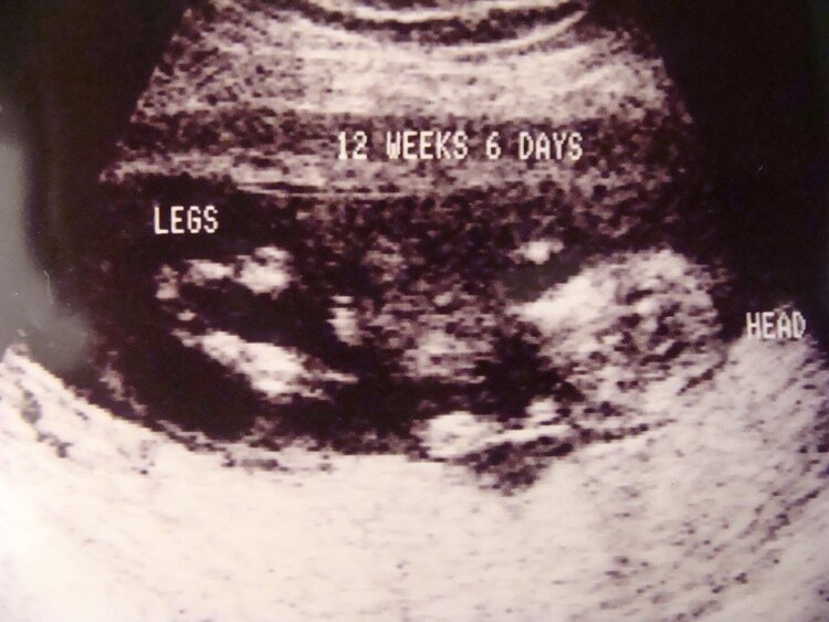 Ultrasound of Baby #5!! 13 weeks!