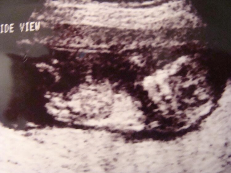 second pic of 13 week ultrasound