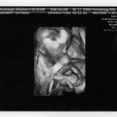 3D of our little man