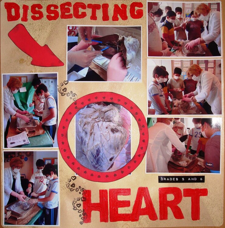 Dissecting Heart