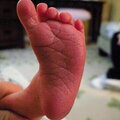 A babys Foot
