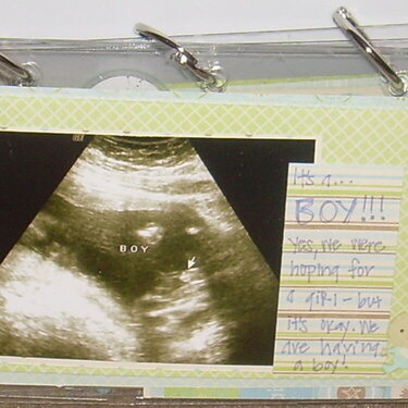 Cayden&#039;s Ultrasound Clear Scrapbook (it&#039;s a boy!)