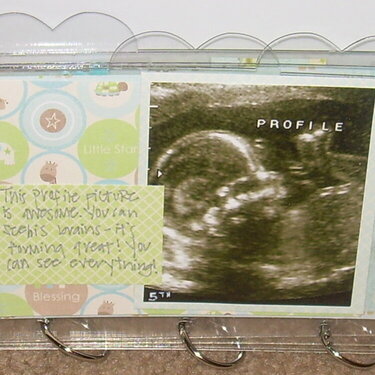 Cayden&#039;s Ultrasound Clear Scrapbook (profile)