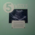 Pregnancy Scrapbook Page 2