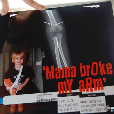 mama broke my arm