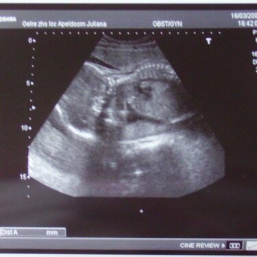 25 weeks ultrasound