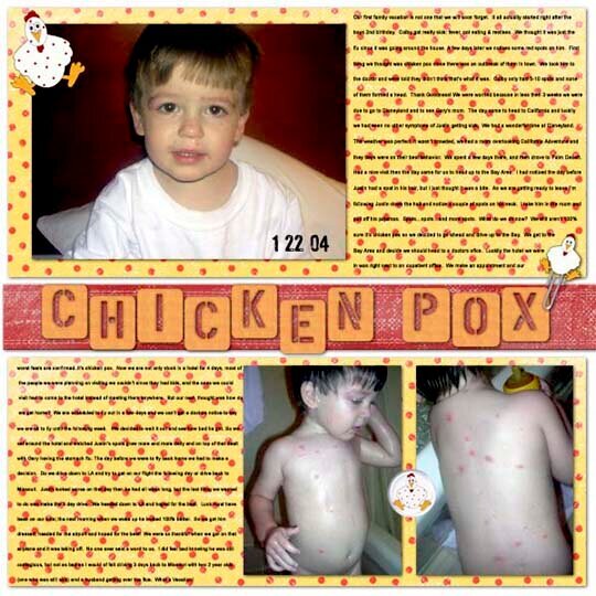 Chicken Pox