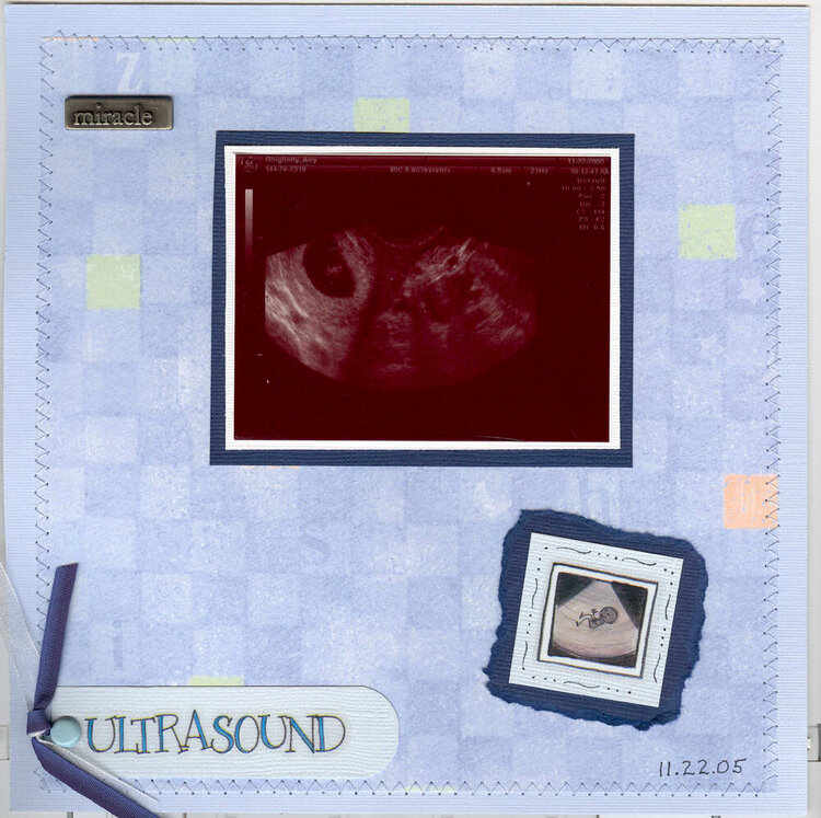 ULTRASOUND