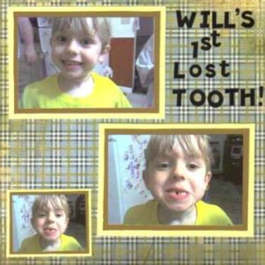 Will&#039;s Lost 1st tooth