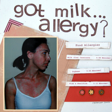 Got Milk...Allergy?