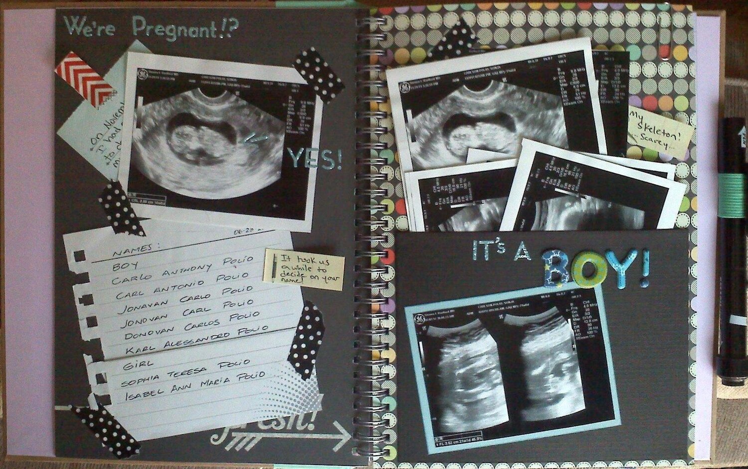  Blank Ultrasound Photo Album: Newborn Scrap Book