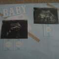 baby ultrasounds