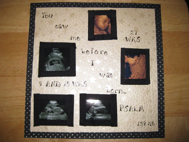 ultrasound page