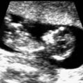 Our First Scan