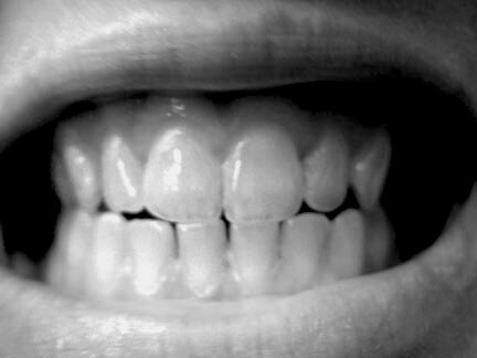 June 8 - Teeth