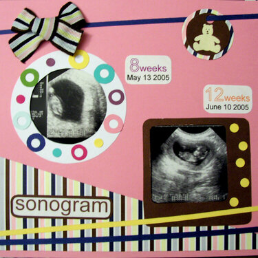 (sonogram) baby first pic 1