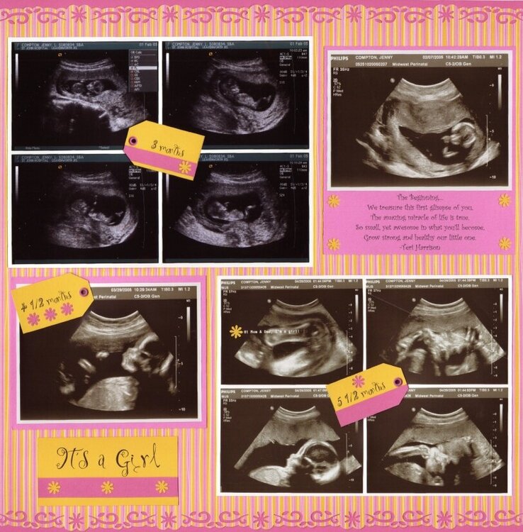 It's a Girl
