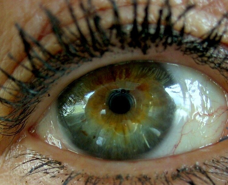 Hazel Eye